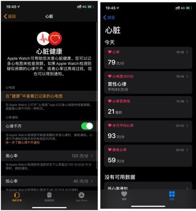 国行 Apple Watch 如何开通 ECG 功能？（国行 apple watch 怎么开通ecg）